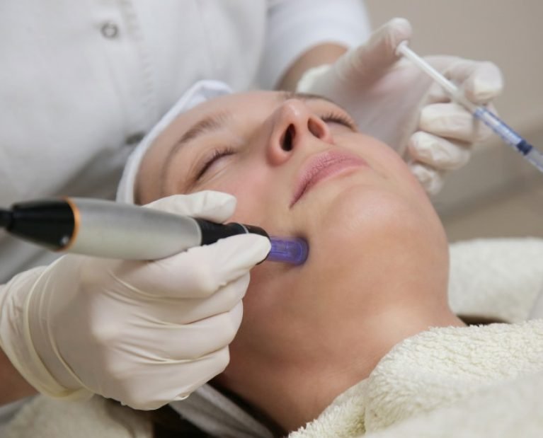 Micro Needling