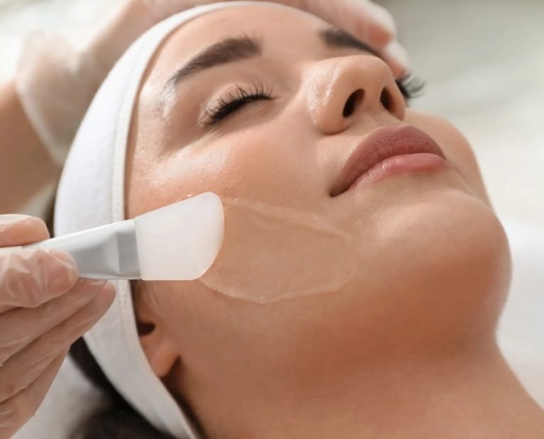 face peel